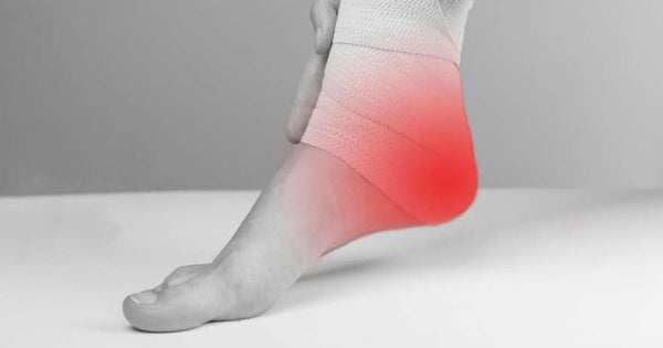 The Rise of Plantar Fasciitis– Everyone's got it…but why?