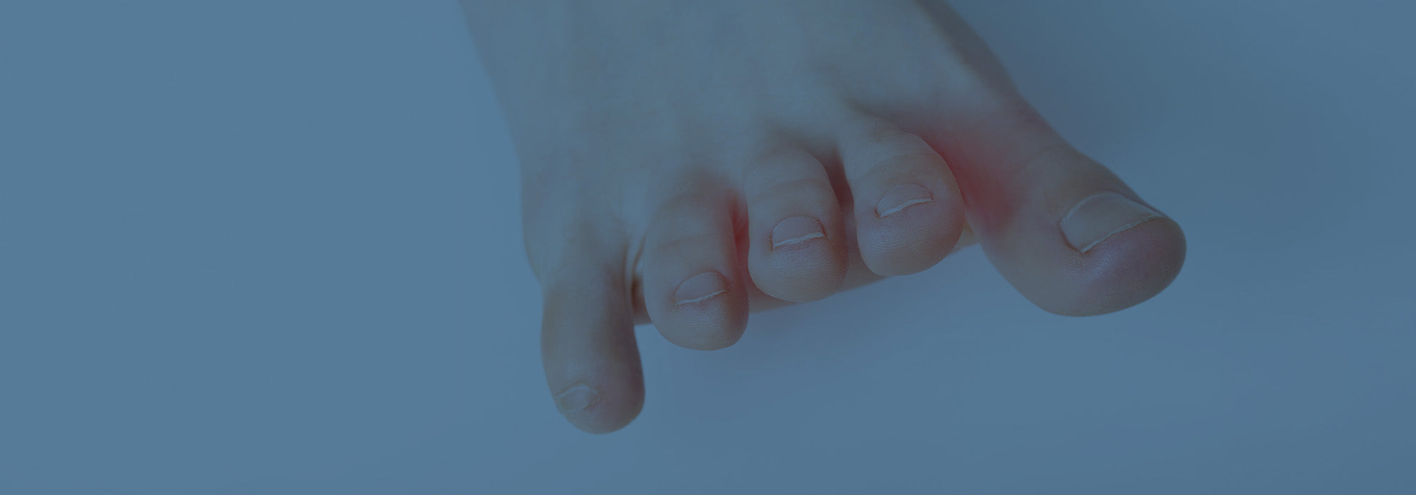 foot with morton's neuroma