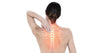 female with back pain