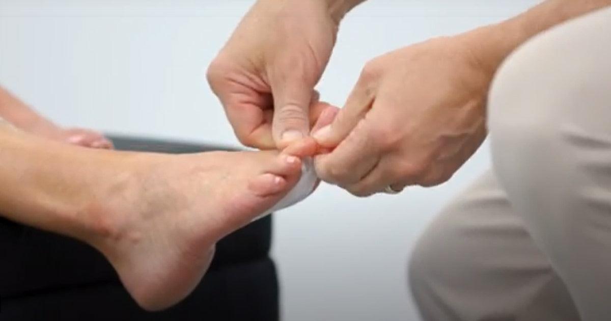 Fixing Hammertoe with tape